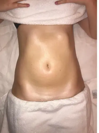 Depois de uma sessão do Método Renata França em Maringá — resultado 3