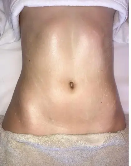 Depois de uma sessão do Método Renata França em Maringá — resultado 6
