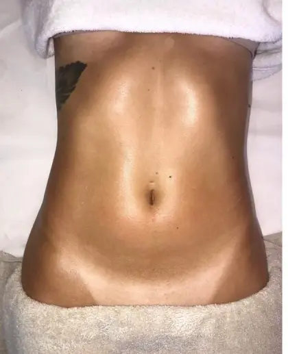 Depois de uma sessão do Método Renata França em Maringá — resultado 7