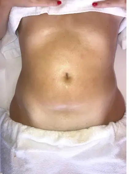 Depois de uma sessão do Método Renata França em Maringá — resultado 8