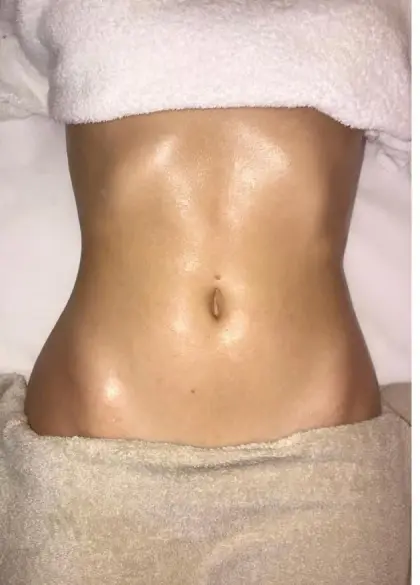 Depois de uma sessão do Método Renata França em Maringá — resultado 9